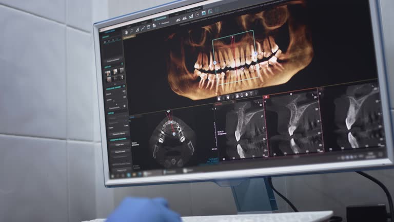 TMJ/TMD Treatment in Orangeburg, SC